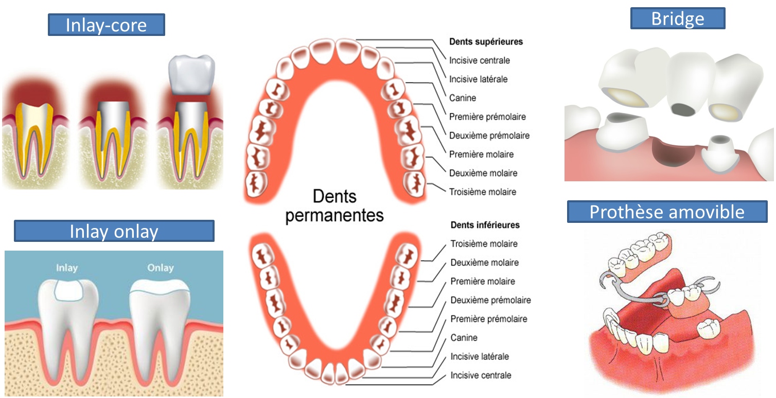 50 Couronnes temporaires 25 antérieures et 25 postérieures Équipement  dentaire Accessoires dentaires 